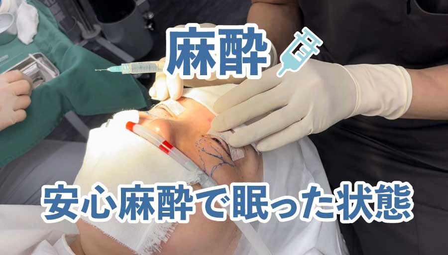 麻酔