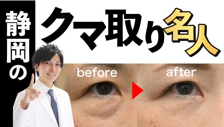 浜松院の目の下のクマ取り！症例数の多い凄腕ドクター【井上礎馬】