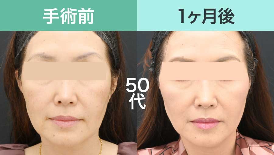 50代女性の症例