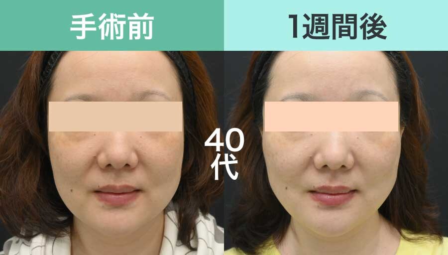 40代女性の症例