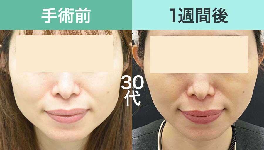 30代女性の症例