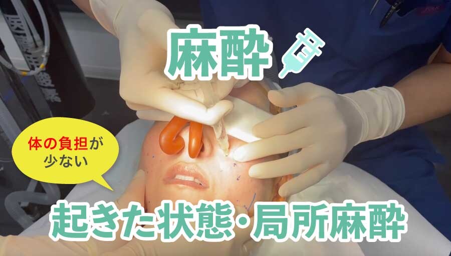 麻酔