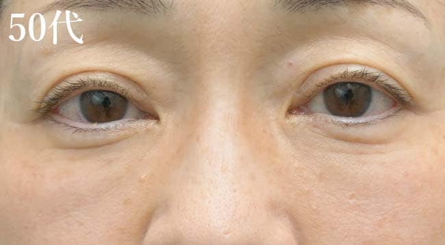 浜松院で人気のクマ取りメニュー