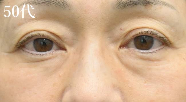 浜松院で人気のクマ取りメニュー