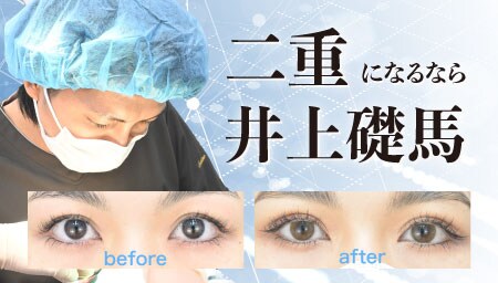 浜松院の二重埋没法で理想の二重に！症例5000件以上の凄腕ドクター【井上礎馬】