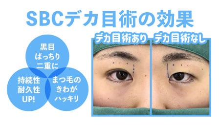 黒目をぱっちり見せるならSBCデカ目術