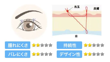 週末二重術