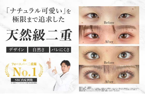 天然級の愛され二重
