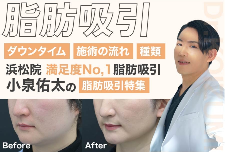 痩身治療1000件以上の実績！浜松院 小泉先生のボコつかない脂肪吸引