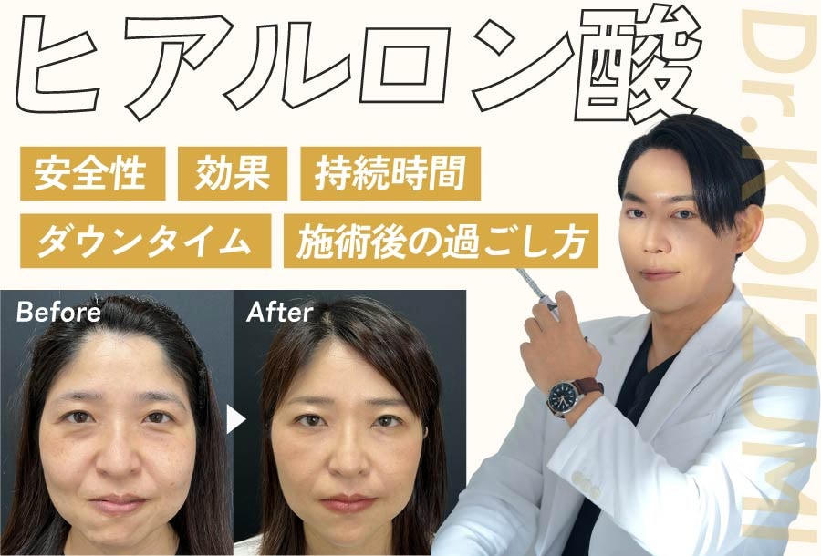 ヒアルロン酸症例数全国No.1！湘南美容クリニック浜松院・小泉先生が選ばれる5つの理由