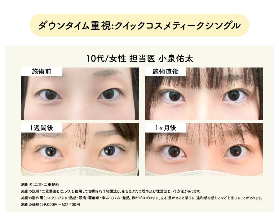 ダウンタイム重視:クイックコスメティークシングル