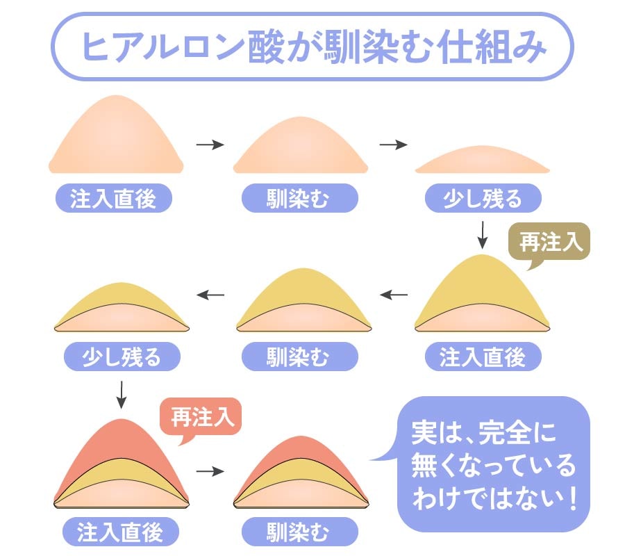 ヒアルロン酸は“溶ける”のではなく“馴染んでいく”