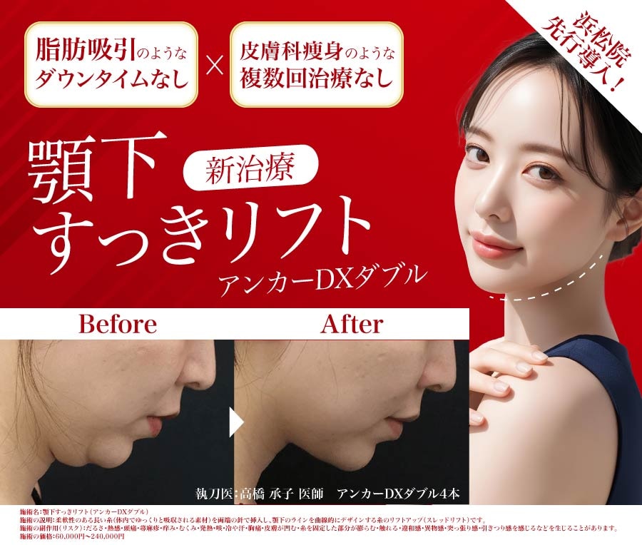 話題の新治療【顎下すっきリフト】とは?二重あご・たるみ改善の効果・脂肪吸引との違い・ダウンタイム・持続性を徹底解説!