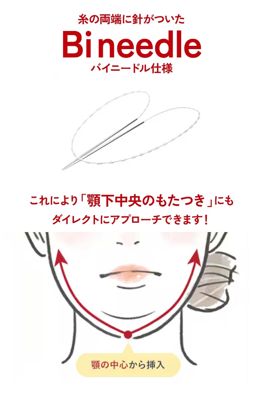 皮下脂肪層に直接作用し、顎下のもたつきをリフトアップ