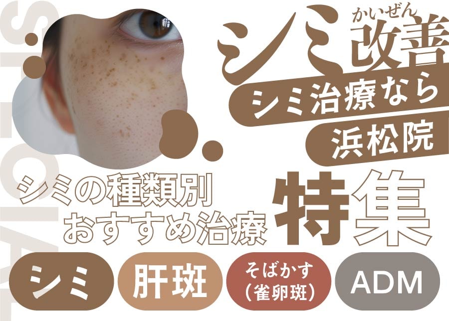 静岡 浜松でシミ取り・シミ治療をお考えの方へ｜シミの種類別おすすめ治療を解説 【湘南美容クリニック浜松院