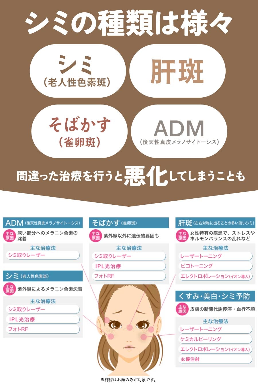 シミには種類があります｜まずは正しい見極めが大切