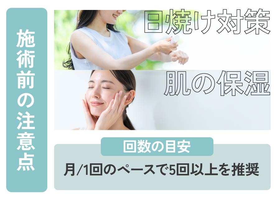 大切な3つのポイント