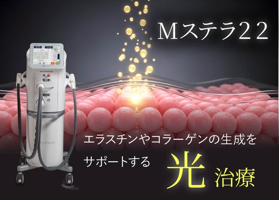 ステラM22による精密なアプローチ