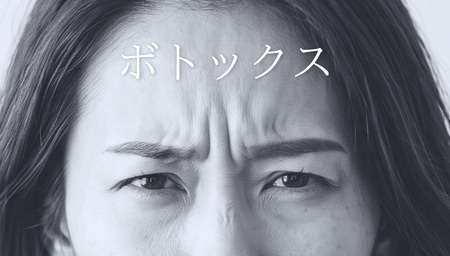 【しわ取り注射（ボトックス）】で未来のシワを予防