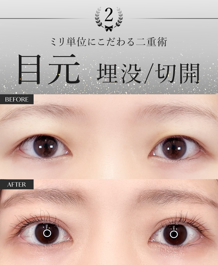【二重整形】なら本間医師にお任せ！経験や実績があるからこそ豊富なメニューでお客様のご要望にお応えいたします。