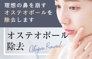 オステオポール除去