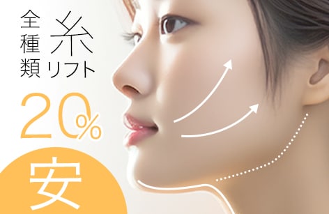 「糸リフト」全種類20%安に！