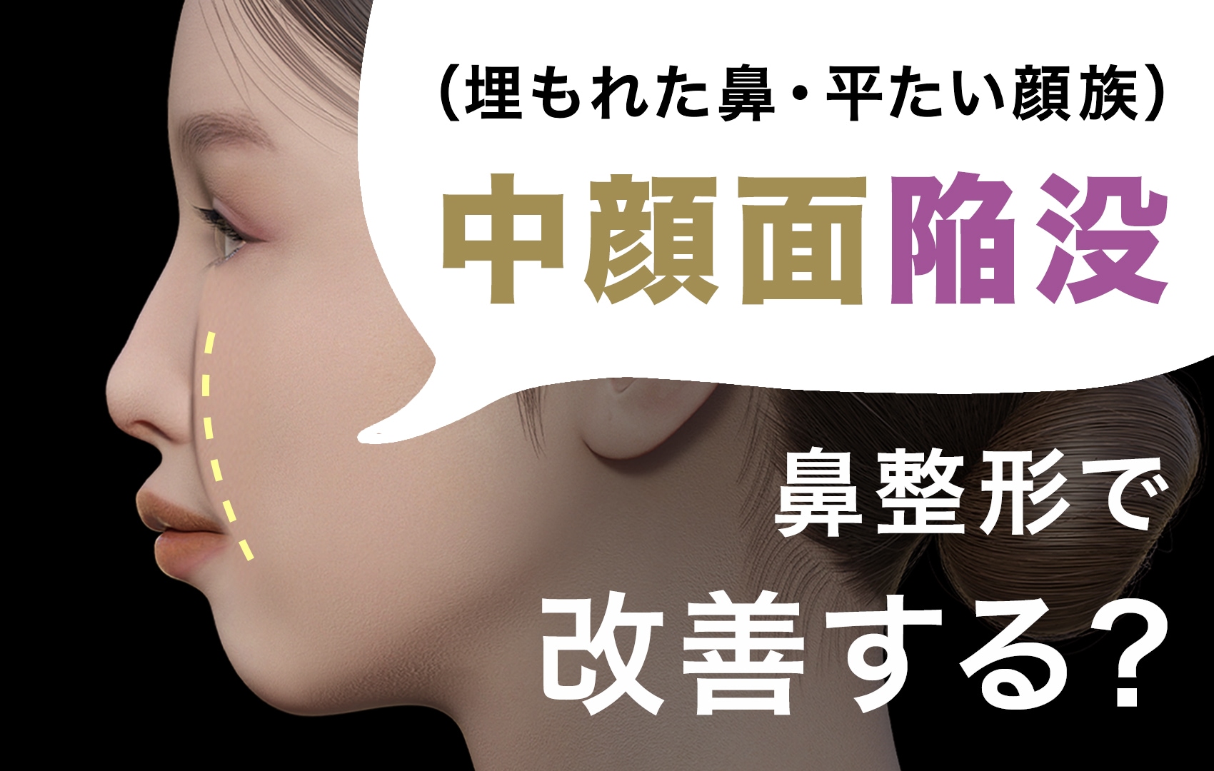 鼻翼 