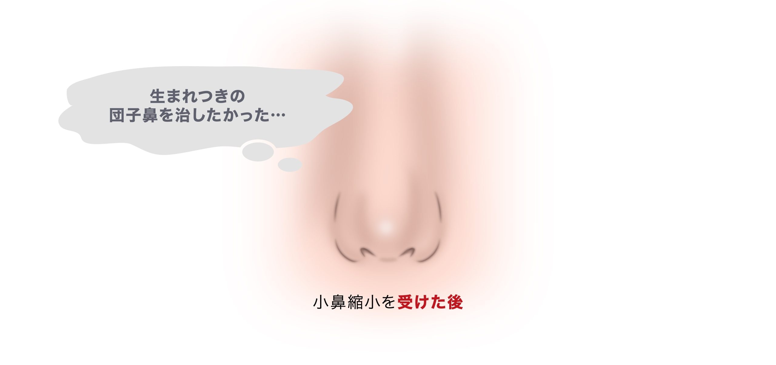 団子鼻が悪化