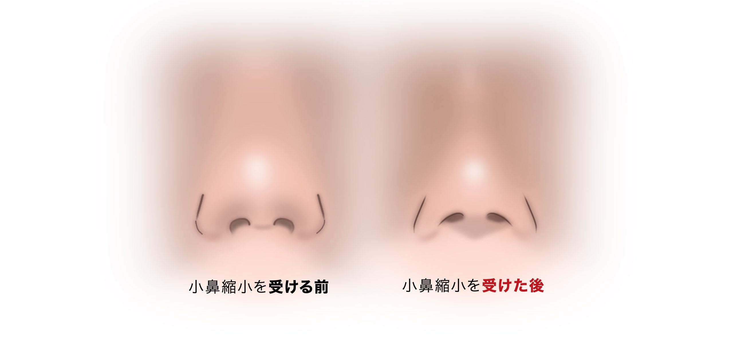 頬に張り付いた鼻に