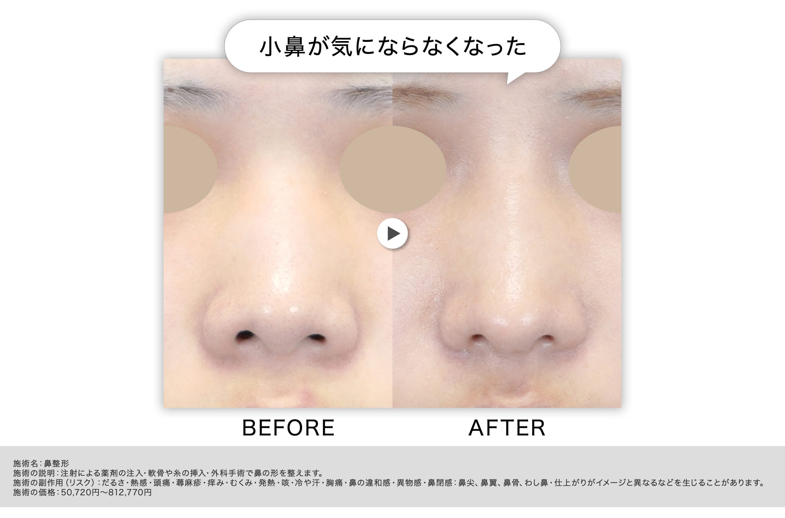 小鼻以外に原因がある