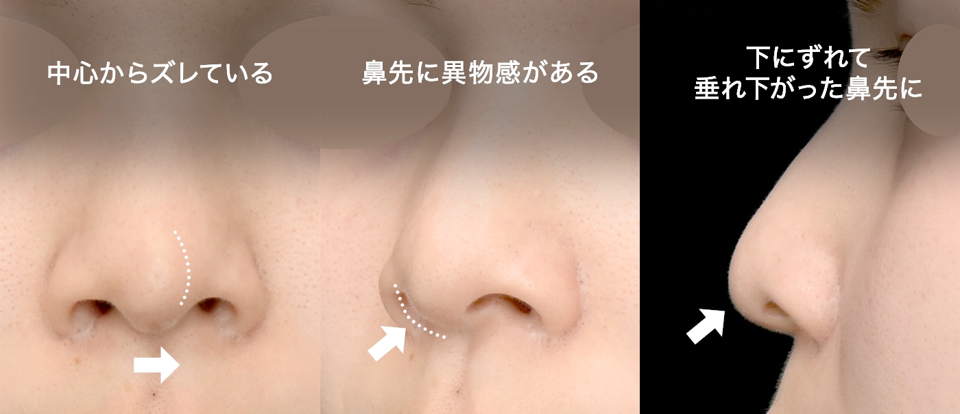 修正事例
