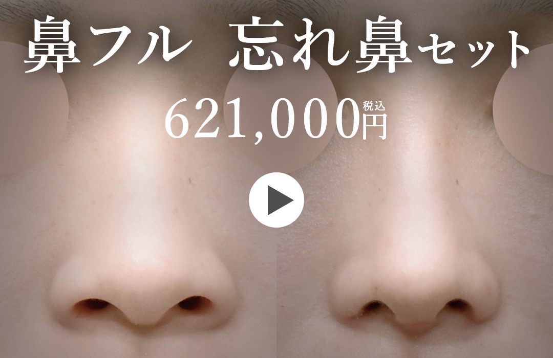 【鼻整形】「鼻フル・忘れ鼻セット」621,000円｜湘南美容クリニック（東京・原宿）で叶える、しっかり変わるのに自然な鼻整形