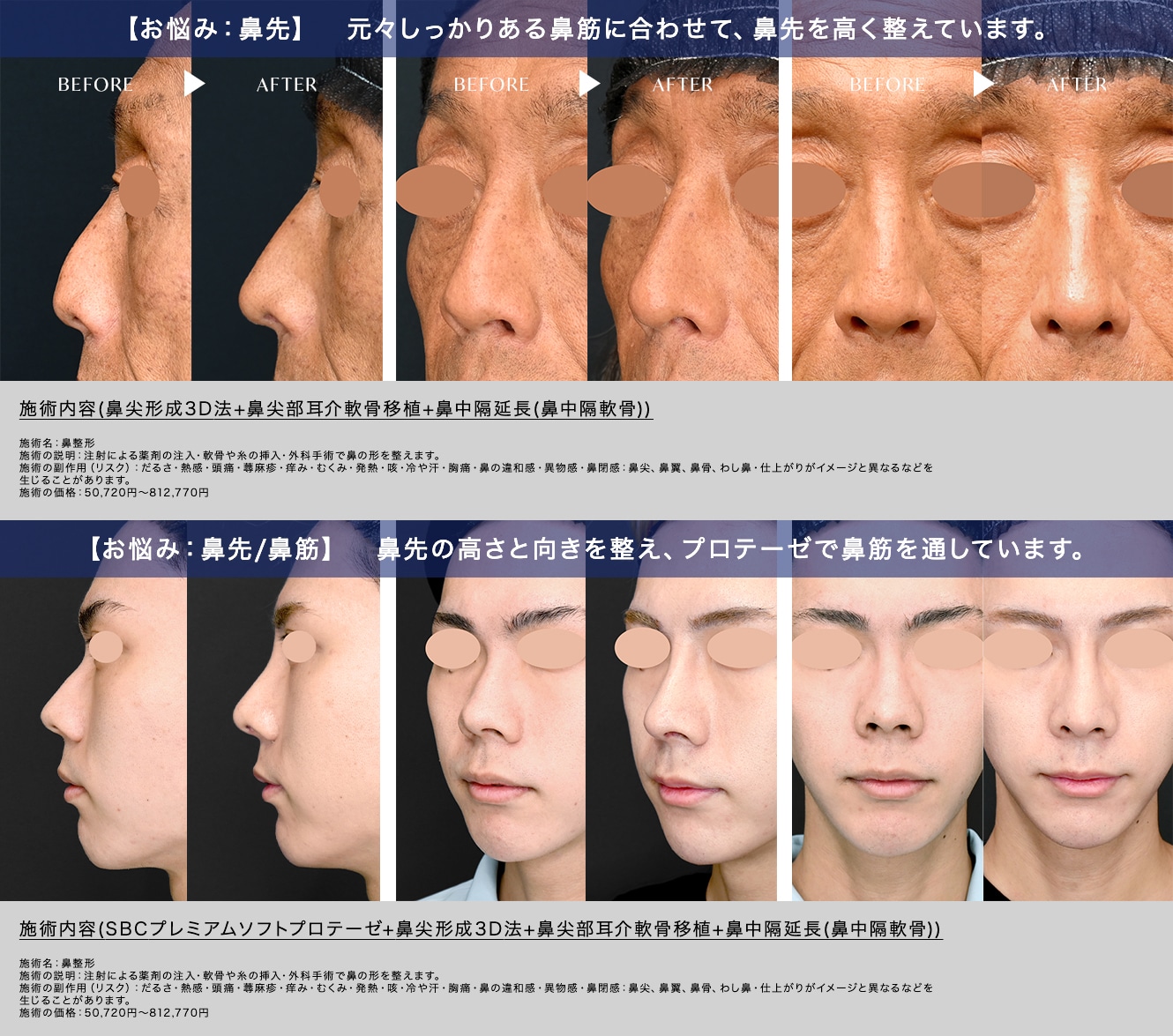 男性に人気の施術