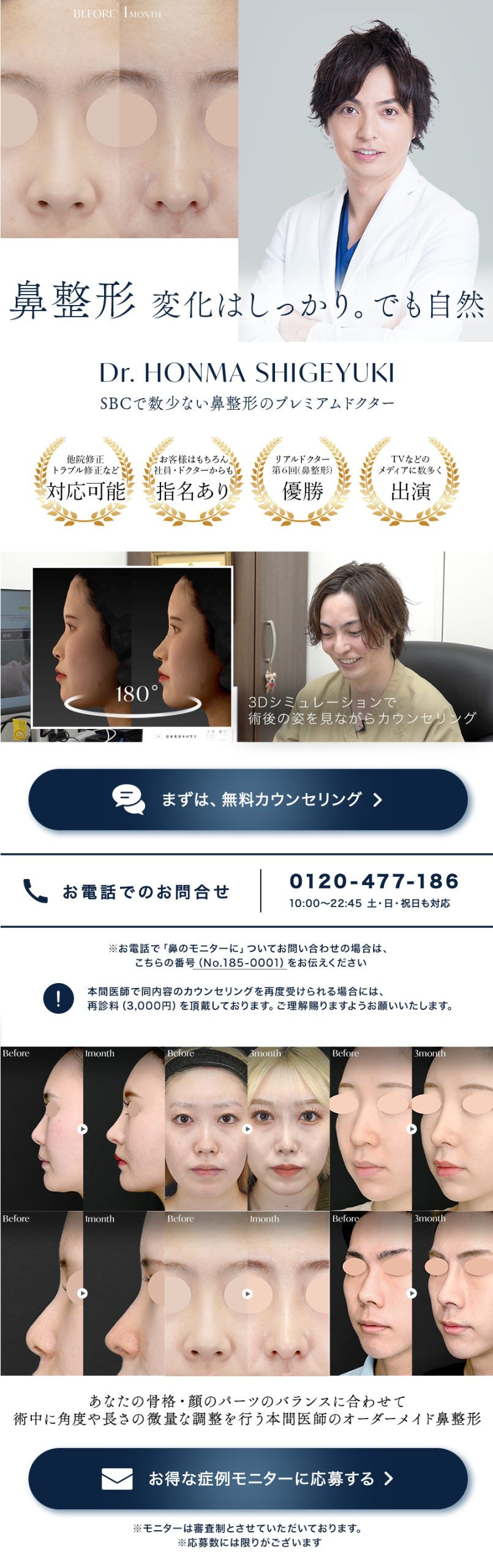 鼻整形で、自分の顔がもっと好きになる