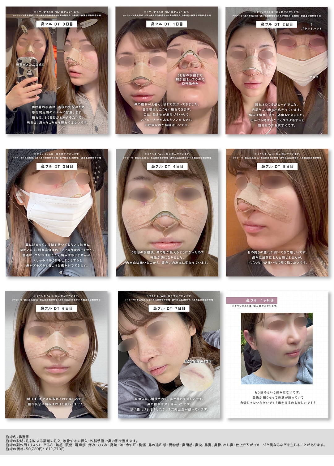 2~3日目がピーク