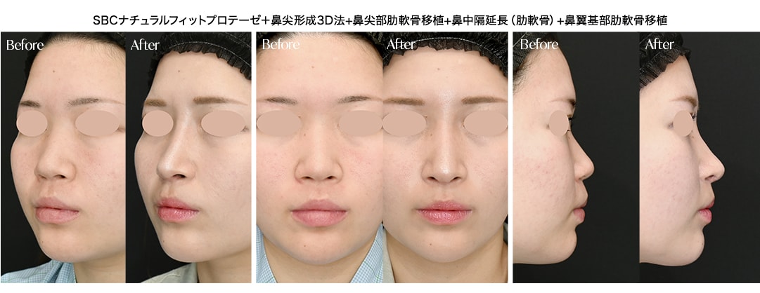 埋まった鼻を持ち上げる