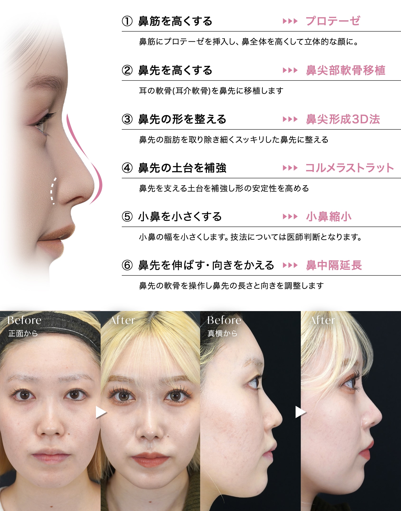 プレミアムプラン