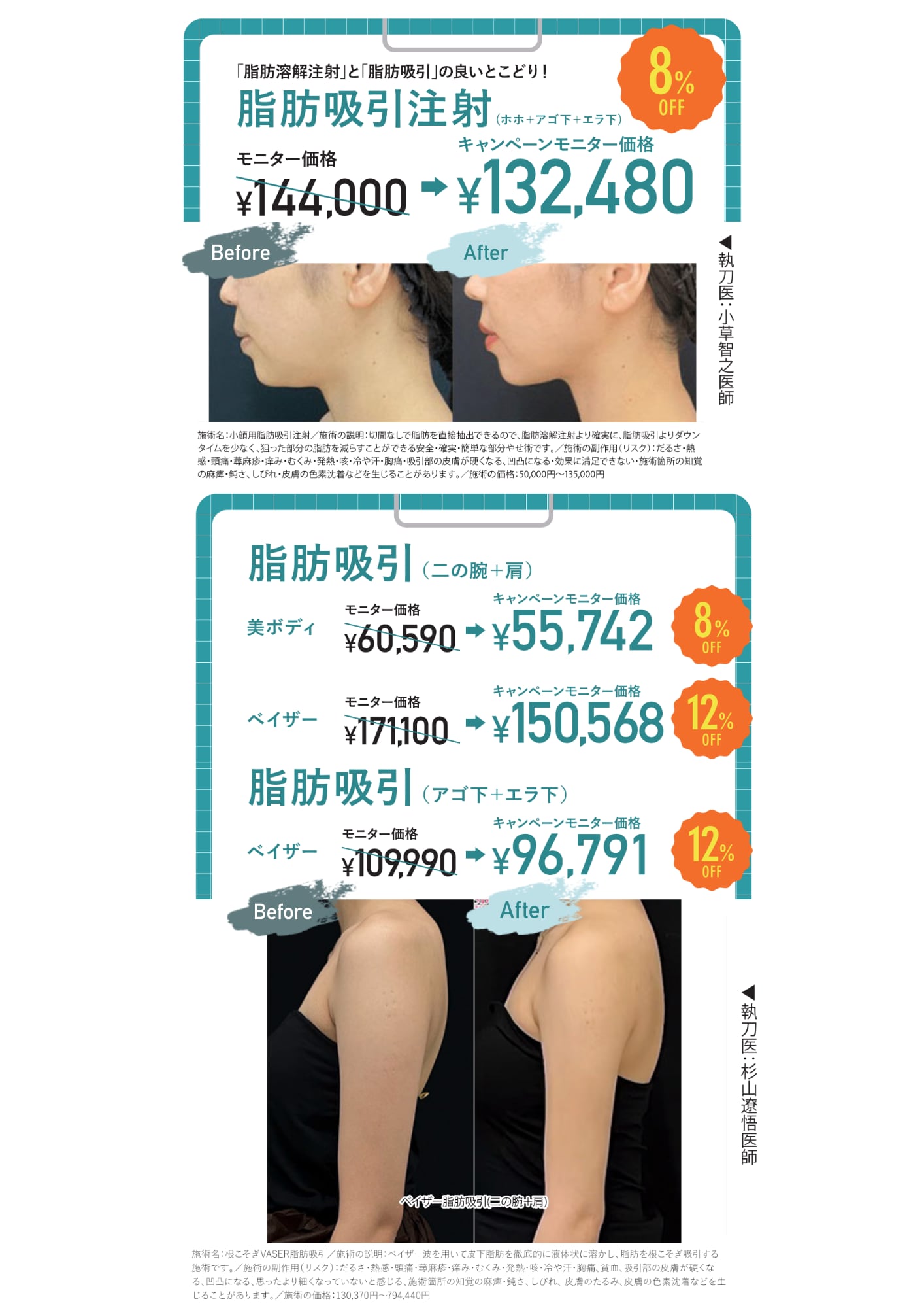 脂肪吸引注射・脂肪吸引