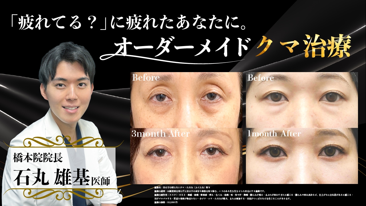 外科と皮膚科のカスタマイズ治療で若返り！橋本院院長石丸医師のモニター募集！