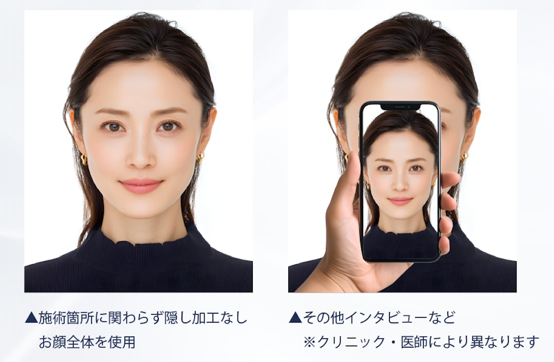 【 全顔モニター 】