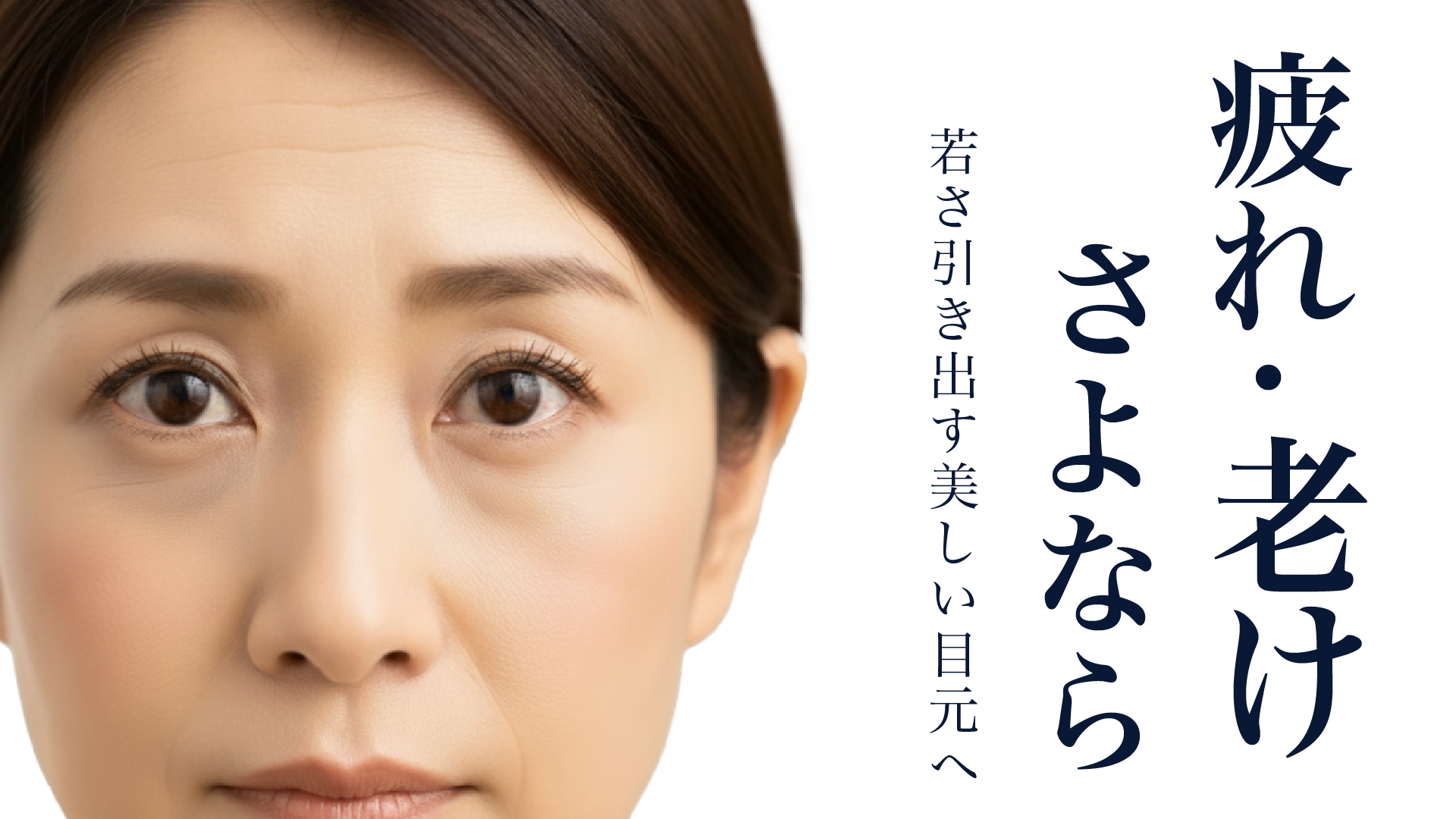 疲れてる？なんて言わせない！目の下のクマやたるみ治療