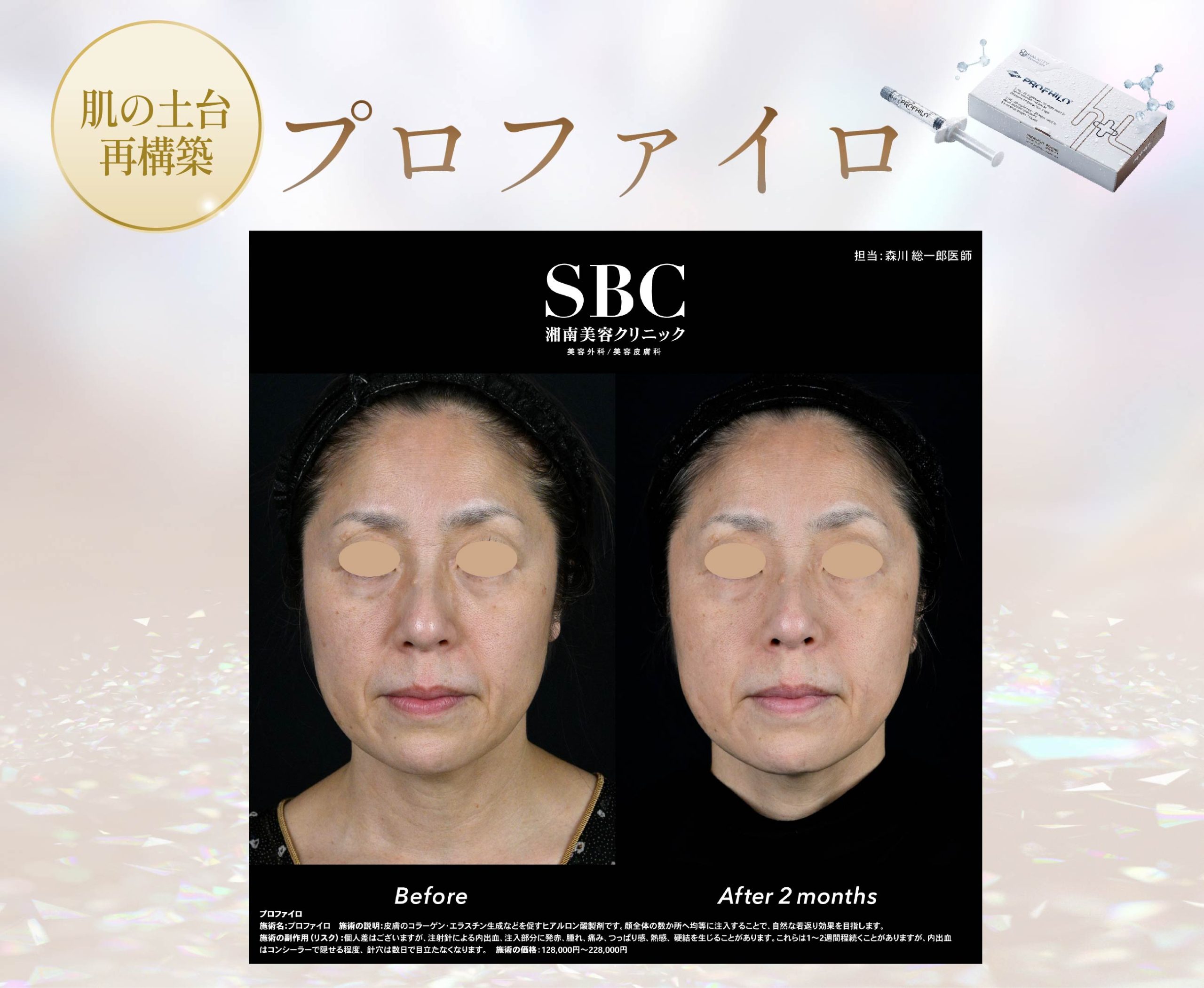 3.プロファイロ