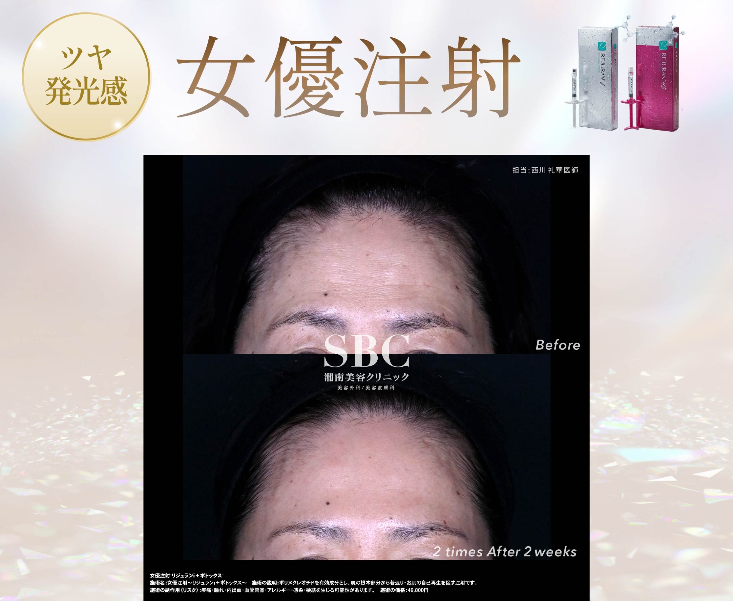 1.女優注射