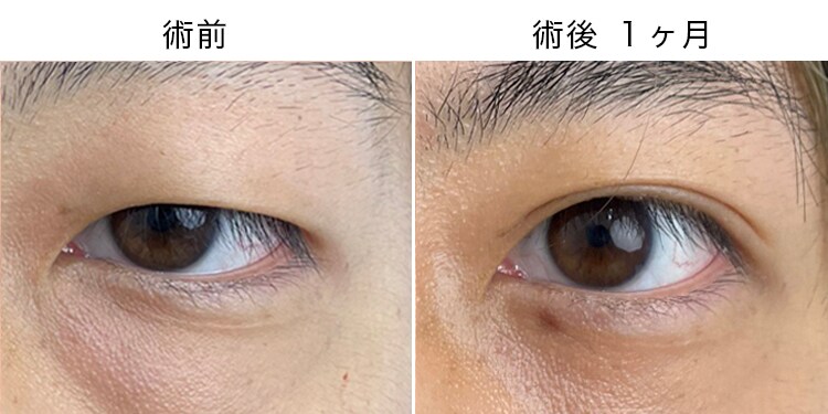 男性にも人気！メンズ 二重