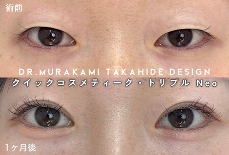 選ばれたプロフェッショナルドクターでしか出来ない施術  クイックコスメティーク・トリプルが施術可能！
