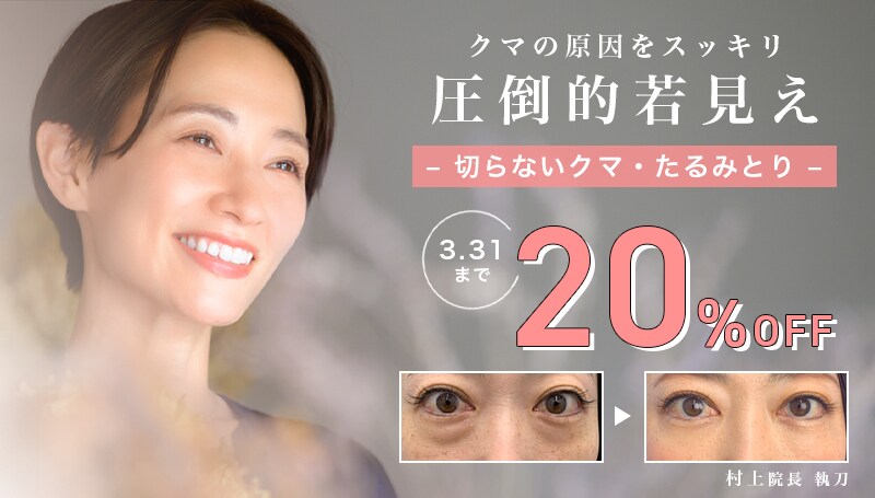 【今月末で終了】クマとり 20% OFF!