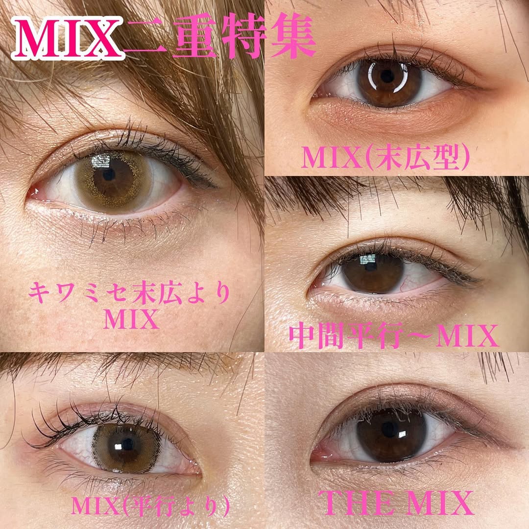 Mix 二重型