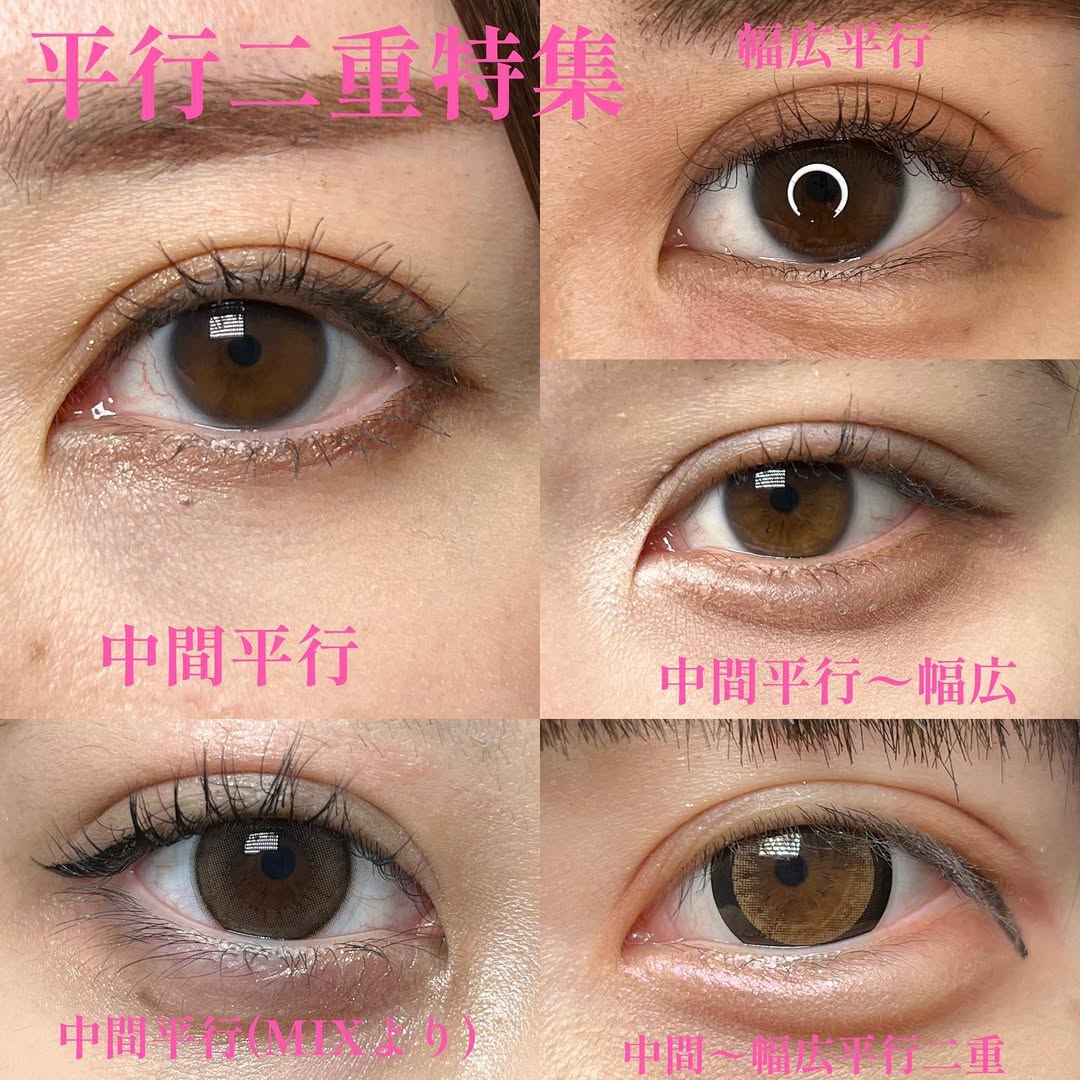 平行二重型