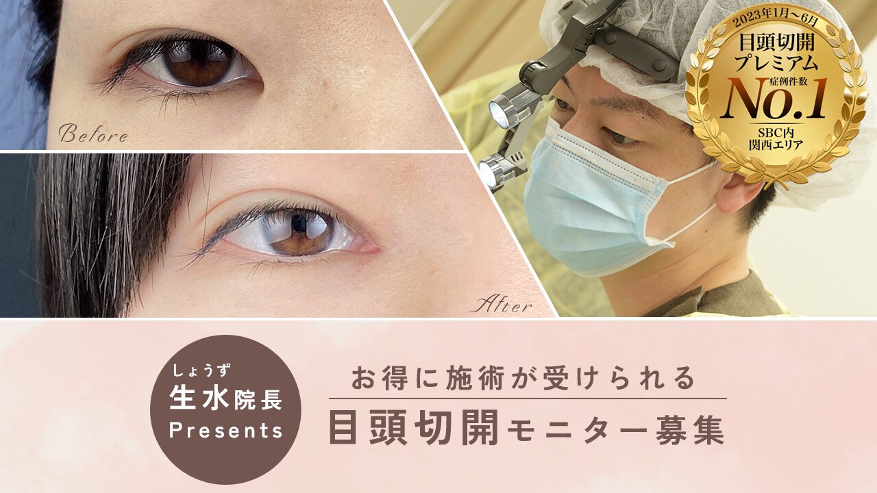 関西No.1 生水院長執刀!垢抜け目元は目頭切開👀