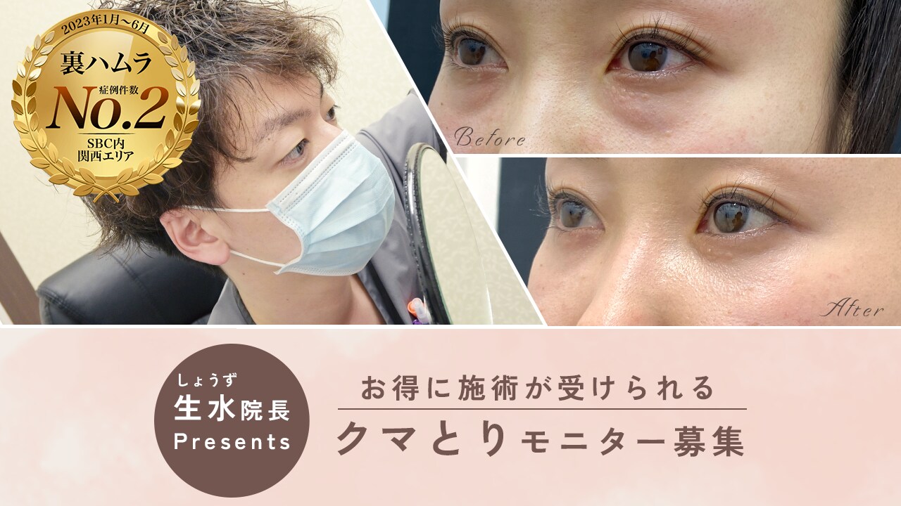 クマとり関西No.2 生水院長執刀!裏ハムラ法でクマをとりませんか🧸